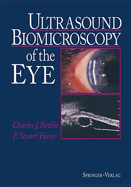 E-Book (pdf) Ultrasound Biomicroscopy of the Eye von Charles J. Pavlin, F. Stuart Foster