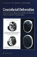 E-Book (pdf) Craniofacial Deformities von David J. David, David C. Hemmy, Rodney D. Cooter