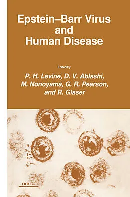 E-Book (pdf) Epstein-Barr Virus and Human Disease von P. H. Levine, D. V. Ablashi, M. Nonoyama