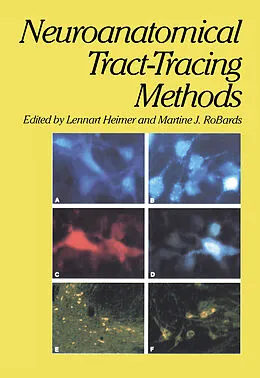 E-Book (pdf) Neuroanatomical Tract-Tracing Methods von Lennart Heimer, Martine J. Robards