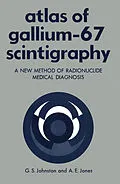 E-Book (pdf) Atlas of Gallium-67 Scintigraphy von Gerald Johnston