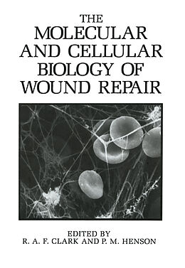 Kartonierter Einband The Molecular and Cellular Biology of Wound Repair von P. M. Henson, R. A. F. Clark