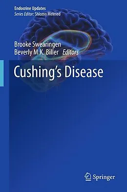 E-Book (pdf) Cushing's Disease von Brooke Swearingen, Beverly M. K. Biller