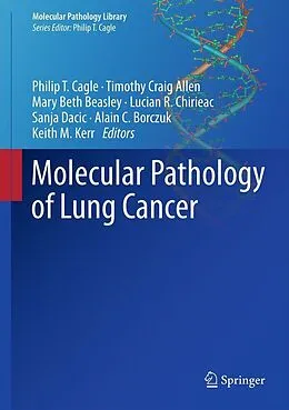 E-Book (pdf) Molecular Pathology of Lung Cancer von Philip T. Cagle, Timothy Craig Allen, Mary Beth Beasley