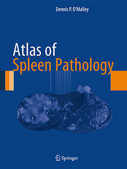 Fester Einband Atlas of Spleen Pathology von Dennis P. O'Malley