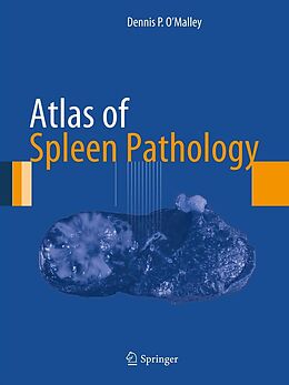 eBook (pdf) Atlas of Spleen Pathology de Dennis P. O'Malley