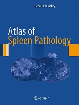 E-Book (pdf) Atlas of Spleen Pathology von Dennis P. O'Malley