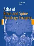 E-Book (pdf) Atlas of Brain and Spine Oncology Imaging von Sasan Karimi
