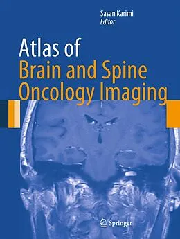 E-Book (pdf) Atlas of Brain and Spine Oncology Imaging von Sasan Karimi