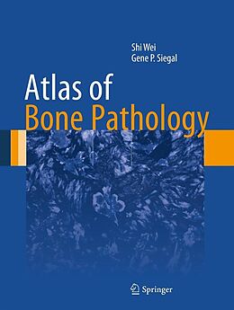 E-Book (pdf) Atlas of Bone Pathology von Shi Wei, Gene P. Siegal