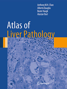 Livre Relié Atlas of Liver Pathology de Anthony W. H. Chan, Alastair Burt, Beate Haugk