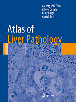 eBook (pdf) Atlas of Liver Pathology de Anthony W. H. Chan, Alberto Quaglia, Beate Haugk