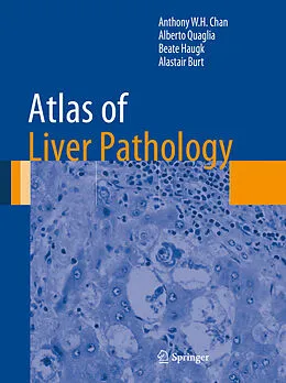 E-Book (pdf) Atlas of Liver Pathology von Anthony W. H. Chan, Alberto Quaglia, Beate Haugk