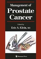 Kartonierter Einband Management of Prostate Cancer von