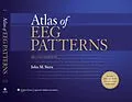 E-Book (pdf) Atlas of EEG Patterns von John M. Stern