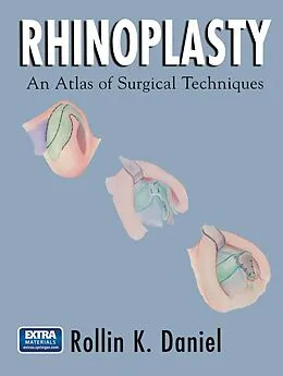 E-Book (pdf) Rhinoplasty von Rollin K. Daniel