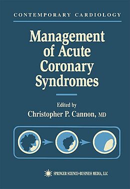 Kartonierter Einband Management of Acute Coronary Syndromes von 