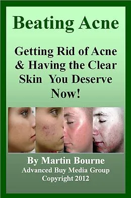 E-Book (epub) Beating Acne: Getting Rid of Acne & Having the Skin You Deserve Now! von Advanced Buy Media Group