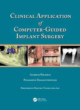 E-Book (pdf) Clinical Application of Computer-Guided Implant Surgery von Andreas Parashis, Panagiotis Diamantopoulos