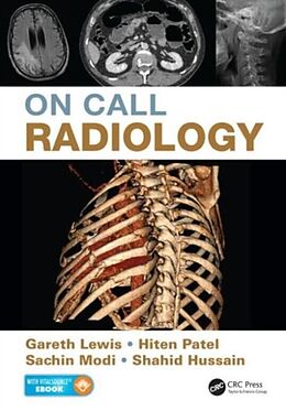 Kartonierter Einband On Call Radiology von Gareth Lewis, Sachin Modi, Hiten Patel
