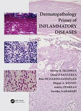 E-Book (pdf) Dermatopathology Primer of Inflammatory Diseases von Steven R. Feldman, Omar P. Sangueza, Rita Pichardo-Geisinger