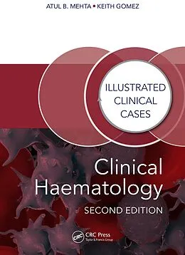 E-Book (pdf) Clinical Haematology von Atul Bhanu Mehta, Keith Gomez