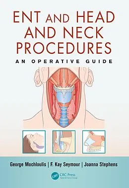 E-Book (pdf) ENT and Head and Neck Procedures von George Mochloulis, F. Kay Seymour, Joanna Stephens