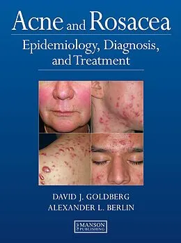 E-Book (epub) Acne and Rosacea von David Goldberg, Alexander Berlin
