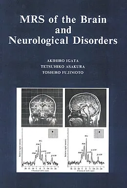E-Book (pdf) MRS of the Brain and Neurological Disorders von Akihiro Igata, Tetsuhiko Asakura, Toshiro Fujimoto