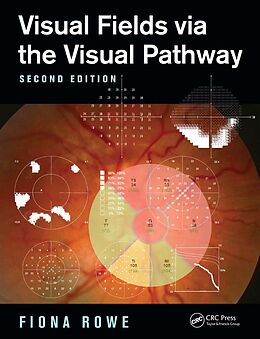 E-Book (pdf) Visual Fields via the Visual Pathway von Fiona Rowe