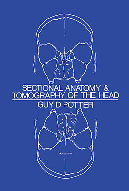 E-Book (epub) Sectional Anatomy and Tomography of the Head von Guy D. Potter