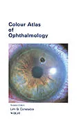 E-Book (epub) Colour Atlas of Ophthalmology von Arthur Lim Siew Ming, Ian J Constable