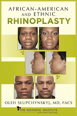 E-Book (epub) African-American and Ethnic Rhinoplasty von MD Oleh Slupchynskyj, FACS
