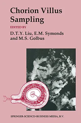 E-Book (pdf) Chorion Villus Sampling von Mitchell S. Golbus, D. T. Y. Liu, E. M. Symonds