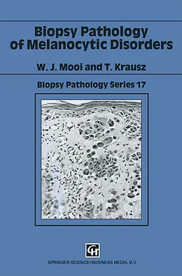 E-Book (pdf) Biopsy Pathology of Melanocytic Disorders von W. J. Mooi, T. Krausz