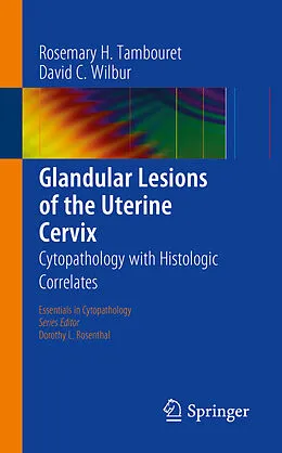 E-Book (pdf) Glandular Lesions of the Uterine Cervix von Rosemary H. Tambouret, David C. Wilbur