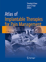 E-Book (pdf) Atlas of Implantable Therapies for Pain Management von 