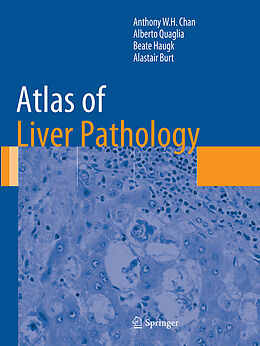 Couverture cartonnée Atlas of Liver Pathology de Anthony W. H. Chan, Alastair Burt, Beate Haugk