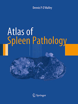 Kartonierter Einband Atlas of Spleen Pathology von Dennis P. O'Malley