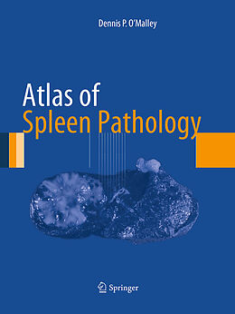 Couverture cartonnée Atlas of Spleen Pathology de Dennis P. O'Malley