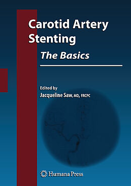 Couverture cartonnée Carotid Artery Stenting: The Basics de 