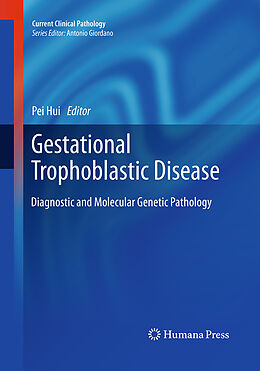 Kartonierter Einband Gestational Trophoblastic Disease von 