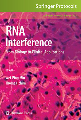 Kartonierter Einband RNA Interference von 