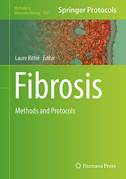 Fester Einband Fibrosis von 