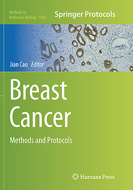 Kartonierter Einband Breast Cancer von 
