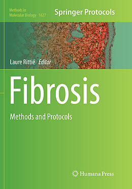 Kartonierter Einband Fibrosis von 