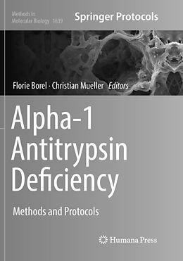 Kartonierter Einband Alpha-1 Antitrypsin Deficiency von 