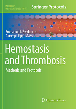 Kartonierter Einband Hemostasis and Thrombosis von 