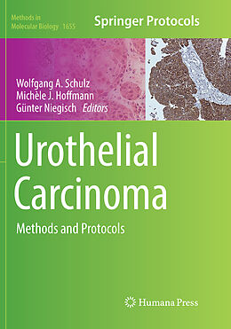Kartonierter Einband Urothelial Carcinoma von 