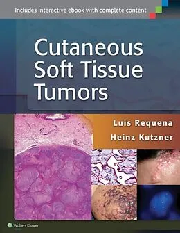 E-Book (epub) Cutaneous Soft Tissue Tumors von Luis Requena